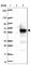Coiled-Coil Domain Containing 97 antibody, HPA043320, Atlas Antibodies, Western Blot image 