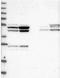 Nudix Hydrolase 21 antibody, NBP2-13682, Novus Biologicals, Western Blot image 
