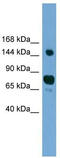 Cytosolic carboxypeptidase 1 antibody, TA333833, Origene, Western Blot image 