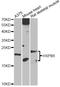 Heat Shock Protein Family B (Small) Member 6 antibody, LS-C749168, Lifespan Biosciences, Western Blot image 