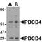 Programmed Cell Death 4 antibody, NBP1-76738, Novus Biologicals, Western Blot image 