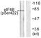 Eukaryotic Translation Initiation Factor 4B antibody, LS-C198912, Lifespan Biosciences, Western Blot image 