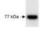 Fermitin Family Member 1 antibody, TA309660, Origene, Western Blot image 