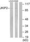 Janus Kinase And Microtubule Interacting Protein 2 antibody, LS-B8428, Lifespan Biosciences, Western Blot image 