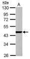 Actin Alpha Cardiac Muscle 1 antibody, NBP1-33759, Novus Biologicals, Western Blot image 