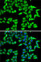 RB Binding Protein 5, Histone Lysine Methyltransferase Complex Subunit antibody, 22-592, ProSci, Immunofluorescence image 