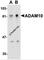 ADAM Metallopeptidase Domain 10 antibody, 2051, ProSci, Western Blot image 