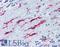 Integrin Subunit Beta 2 antibody, LS-B1849, Lifespan Biosciences, Immunohistochemistry frozen image 