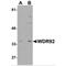 WD Repeat Domain 92 antibody, MBS151037, MyBioSource, Western Blot image 