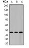 Gamma-Butyrobetaine Hydroxylase 1 antibody, abx141494, Abbexa, Western Blot image 