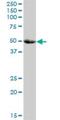 Sphingomyelin Phosphodiesterase Acid Like 3A antibody, H00010924-B01P, Novus Biologicals, Western Blot image 