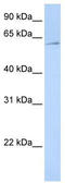 Eukaryotic Translation Initiation Factor 3 Subunit L antibody, TA346622, Origene, Western Blot image 