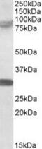 Tripartite Motif Containing 2 antibody, TA305745, Origene, Western Blot image 