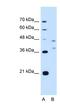 Ecotropic Viral Integration Site 2B antibody, NBP1-59952, Novus Biologicals, Western Blot image 