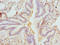 Ficolin 1 antibody, LS-C675750, Lifespan Biosciences, Immunohistochemistry paraffin image 