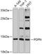 Podoplanin antibody, GTX64376, GeneTex, Western Blot image 
