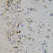 Mitogen-Activated Protein Kinase 11 antibody, A03738, Boster Biological Technology, Immunohistochemistry paraffin image 