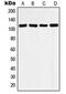 Histone Deacetylase 9 antibody, MBS820865, MyBioSource, Western Blot image 