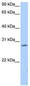 Nuclear Receptor Interacting Protein 3 antibody, TA339739, Origene, Western Blot image 