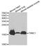 Troponin C, slow skeletal and cardiac muscles antibody, MBS128094, MyBioSource, Western Blot image 