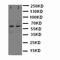 NADPH Oxidase 1 antibody, LS-C312889, Lifespan Biosciences, Western Blot image 