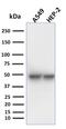 Keratin 18 antibody, GTX34637, GeneTex, Western Blot image 