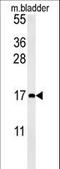 C-C Motif Chemokine Ligand 4 antibody, LS-C168457, Lifespan Biosciences, Western Blot image 