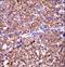 Eukaryotic Translation Initiation Factor 5A2 antibody, LS-C167715, Lifespan Biosciences, Immunohistochemistry frozen image 