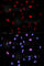 Mitogen-Activated Protein Kinase Kinase 6 antibody, AP0081, ABclonal Technology, Immunofluorescence image 