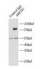 ATP Binding Cassette Subfamily D Member 2 antibody, FNab00038, FineTest, Immunoprecipitation image 