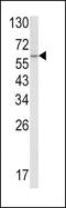 CTD Small Phosphatase 2 antibody, PA5-35350, Invitrogen Antibodies, Western Blot image 