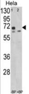 Leiomodin 1 antibody, AP18099PU-N, Origene, Western Blot image 