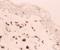 Mannose Receptor antibody, DDX0380P-100, Novus Biologicals, Immunohistochemistry frozen image 