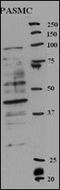 Replication Factor C Subunit 5 antibody, PA5-12418, Invitrogen Antibodies, Western Blot image 