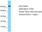 S100 Calcium Binding Protein Z antibody, TA330302, Origene, Western Blot image 