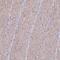 Interleukin 1 Family Member 10 antibody, PA5-63778, Invitrogen Antibodies, Immunohistochemistry frozen image 