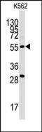 Chloride Intracellular Channel 5 antibody, AP14238PU-N, Origene, Western Blot image 