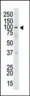 Ubiquitin Specific Peptidase 13 antibody, PA5-12014, Invitrogen Antibodies, Western Blot image 