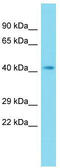 CNPPD1 antibody, TA335585, Origene, Western Blot image 