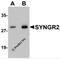 Synaptogyrin 2 antibody, 5565, ProSci, Western Blot image 