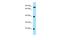 Tetratricopeptide Repeat Domain 4 antibody, A13795, Boster Biological Technology, Western Blot image 