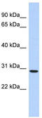 SERTA Domain Containing 2 antibody, TA339233, Origene, Western Blot image 