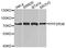 Protein Phosphatase 2 Regulatory Subunit B''Beta antibody, STJ110787, St John