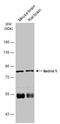 Leucine-rich repeat-containing protein 4C antibody, NBP2-19516, Novus Biologicals, Western Blot image 