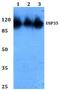 Ubiquitin carboxyl-terminal hydrolase 35 antibody, PA5-37232, Invitrogen Antibodies, Western Blot image 