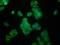 Ubiquitin Conjugating Enzyme E2 G1 antibody, LS-C671348, Lifespan Biosciences, Immunofluorescence image 