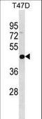 Interleukin 22 Receptor Subunit Alpha 2 antibody, LS-C159918, Lifespan Biosciences, Western Blot image 