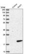 Ring Finger Protein 7 antibody, NBP1-85594, Novus Biologicals, Western Blot image 