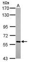 Protein kinase domain-containing protein, cytoplasmic antibody, NBP2-19959, Novus Biologicals, Western Blot image 