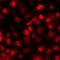 ISL LIM Homeobox 1 antibody, LS-C668483, Lifespan Biosciences, Immunofluorescence image 